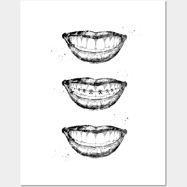 Before, with and after braces Wall Art by erzebeth